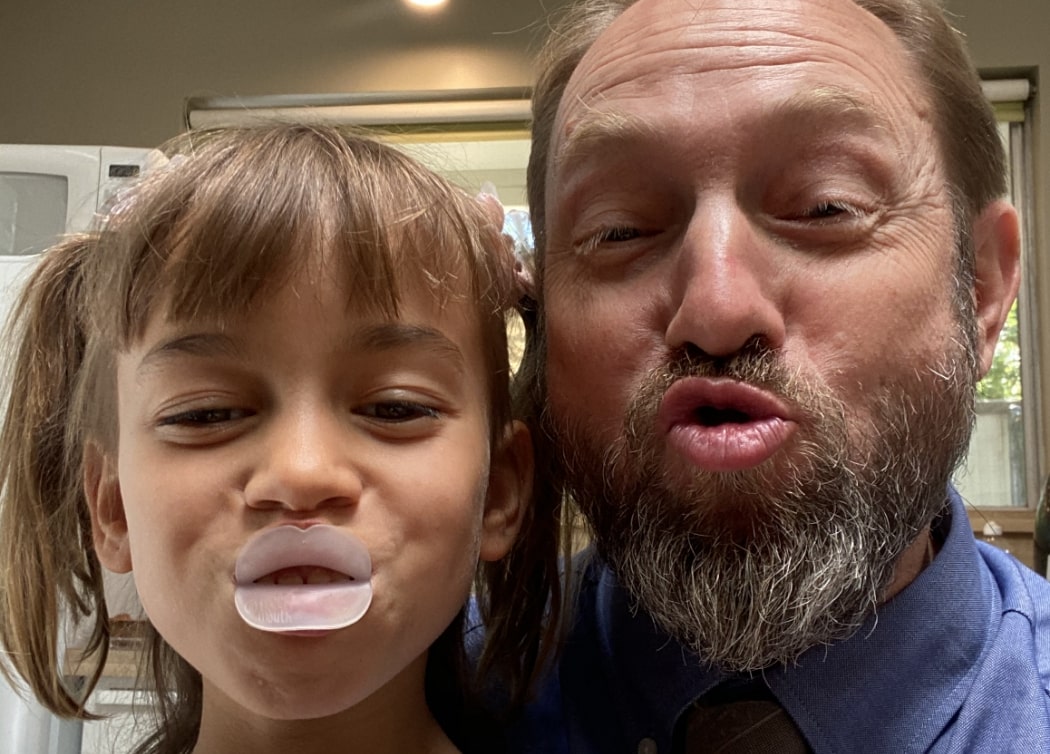 Dr. Kevin Adair, Sacramento Airway Orthodontist goofing around with a little patient.