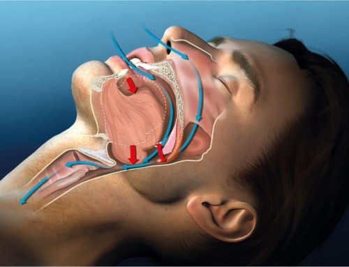 Three-Dimensional Jaw Development: Why Width Alone Isn’t Enough